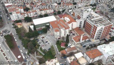 Akhisar’da Lazerle Böbrek Taşı Tedavisi Dönemi Başladı